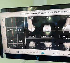 robotic hip replacement surgeon in Pune